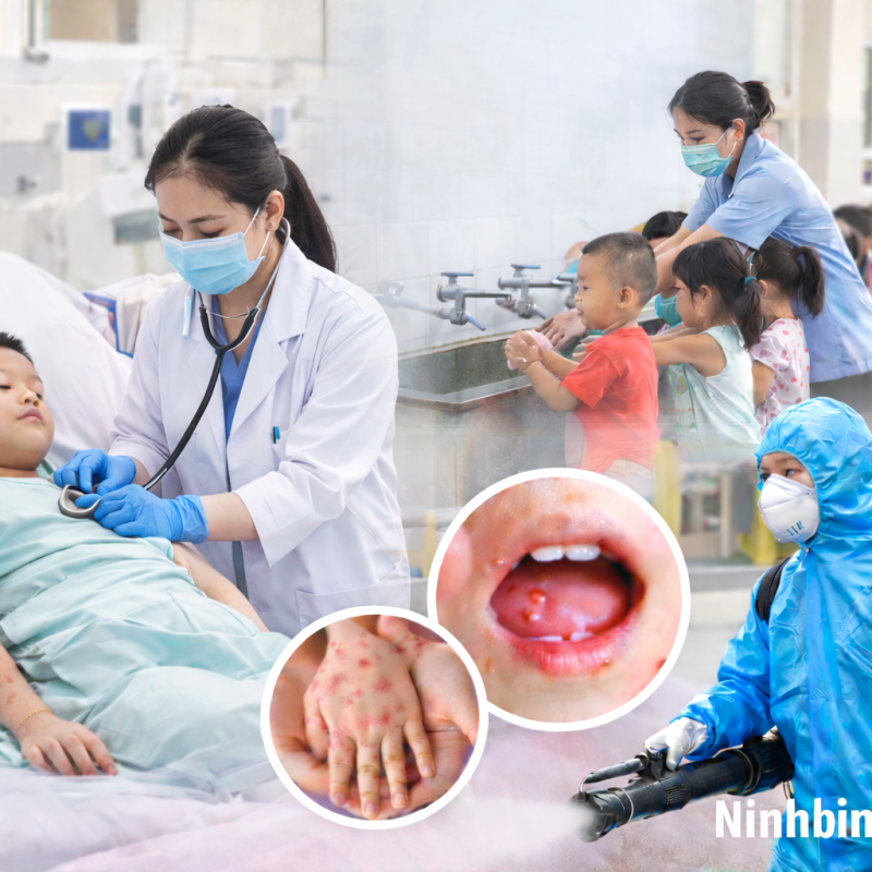 Tăng cường phòng, chống bệnh tay chân miệng và các bệnh truyền nhiễm
