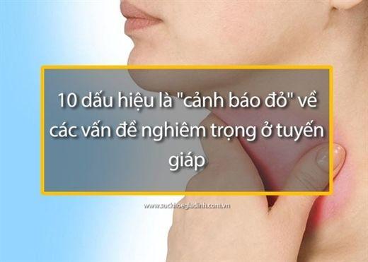 Các đồng chí lãnh đạo xã Vụ Bản thăm và làm việc với Công an xã
