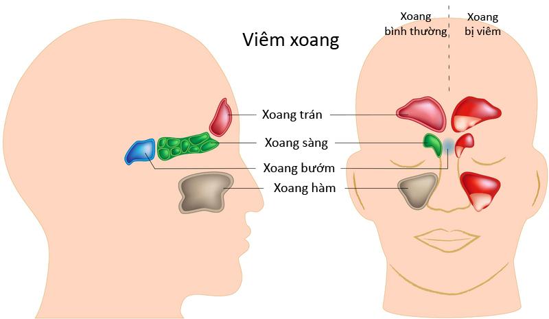 HỘI NGHỊ SƠ KẾT CÔNG TÁC VĂN HÓA, THỂ THAO QUÝ I VÀ TRIỂN KHAI NHIỆM VỤ TRỌNG TÂM QUÝ II NĂM 2024